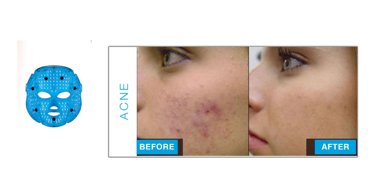 ReVive LED Light Therapy available now at Tanz Tanning